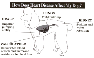 Heart Disease 2